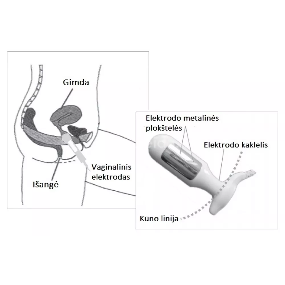 Dubens dugno raumenų stimuliacijos aparatas NeuroTrac CONTINENCE