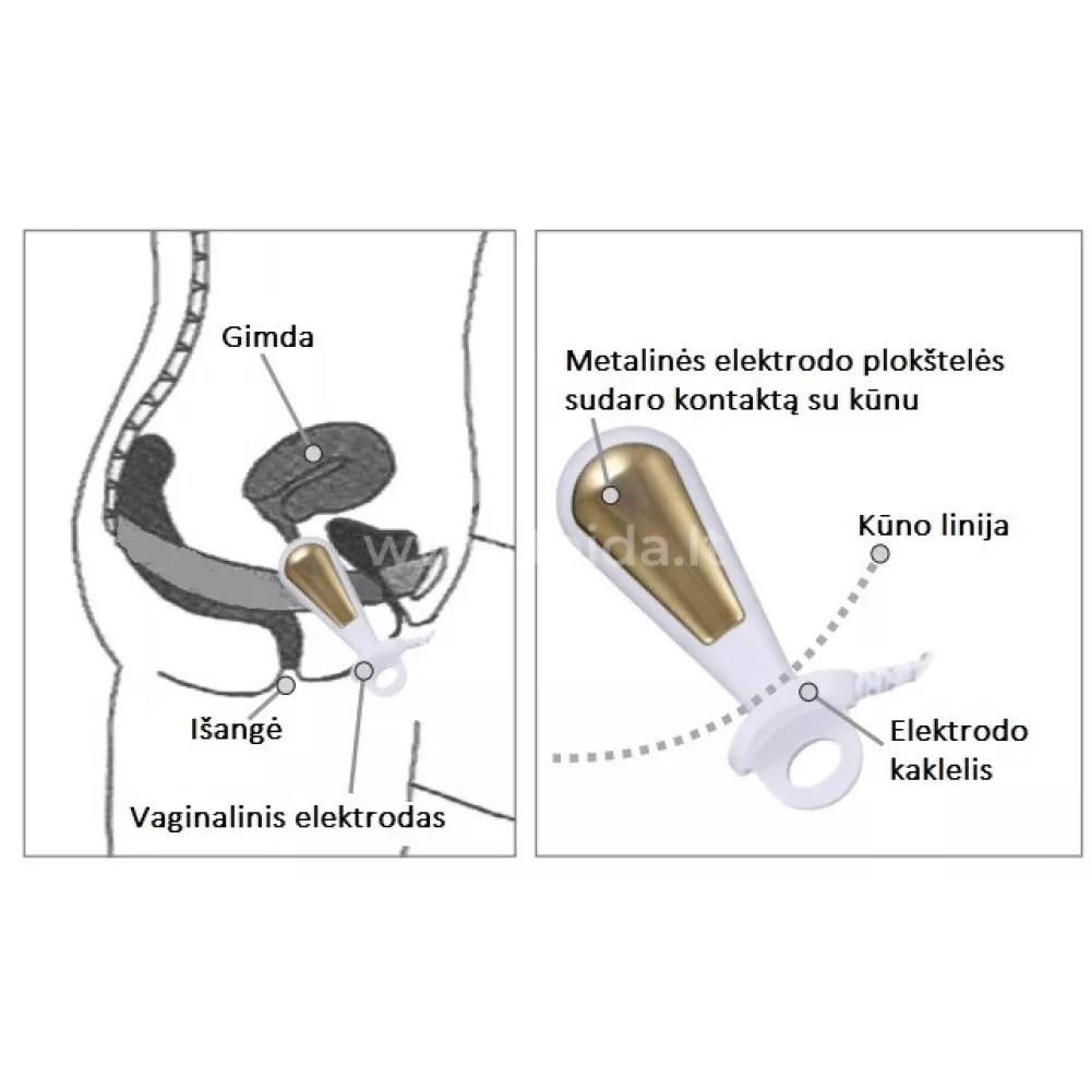 Vaginalinis elektrodas elektrinei stimuliacijai arba stimuliacijai su EMG