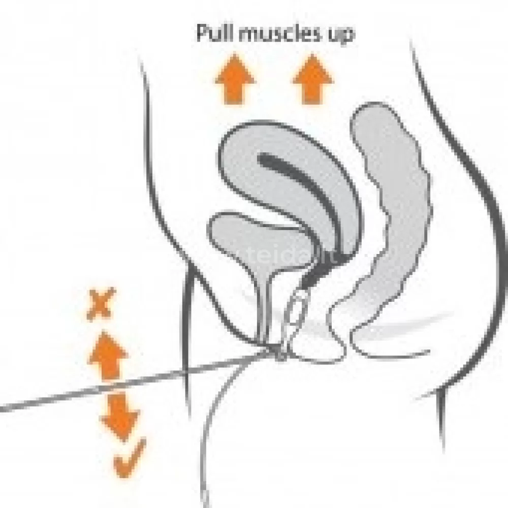 Vaginalinis elektrodas Periform Plus Multilingual