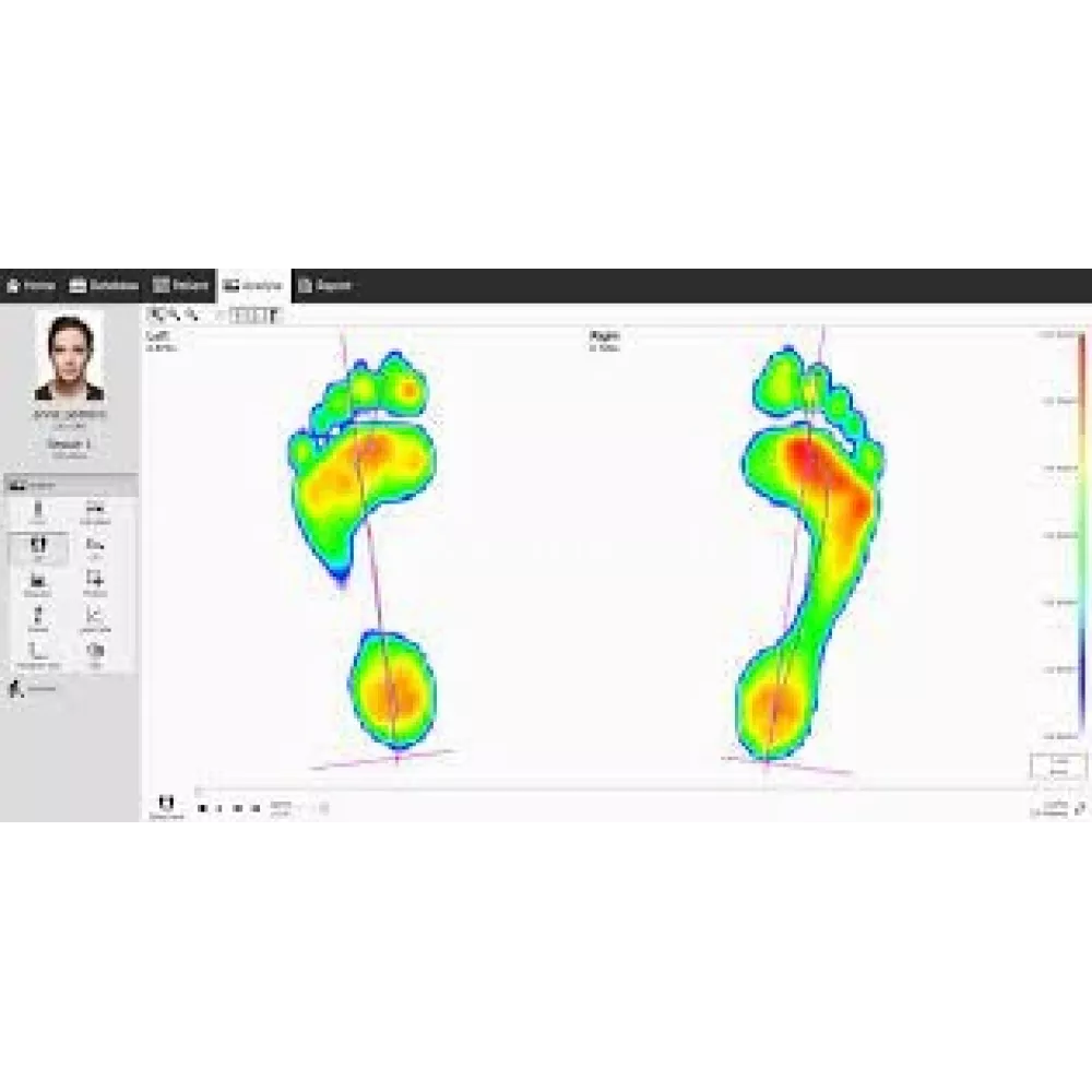 Pėdų skanavimo ir eisenos analizės sistema 0.5 m