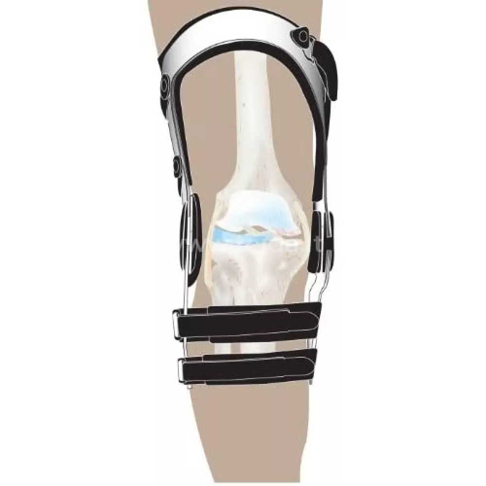 DonJoy ARMOR kelio įtvaras FP, ST, dešinė, XL