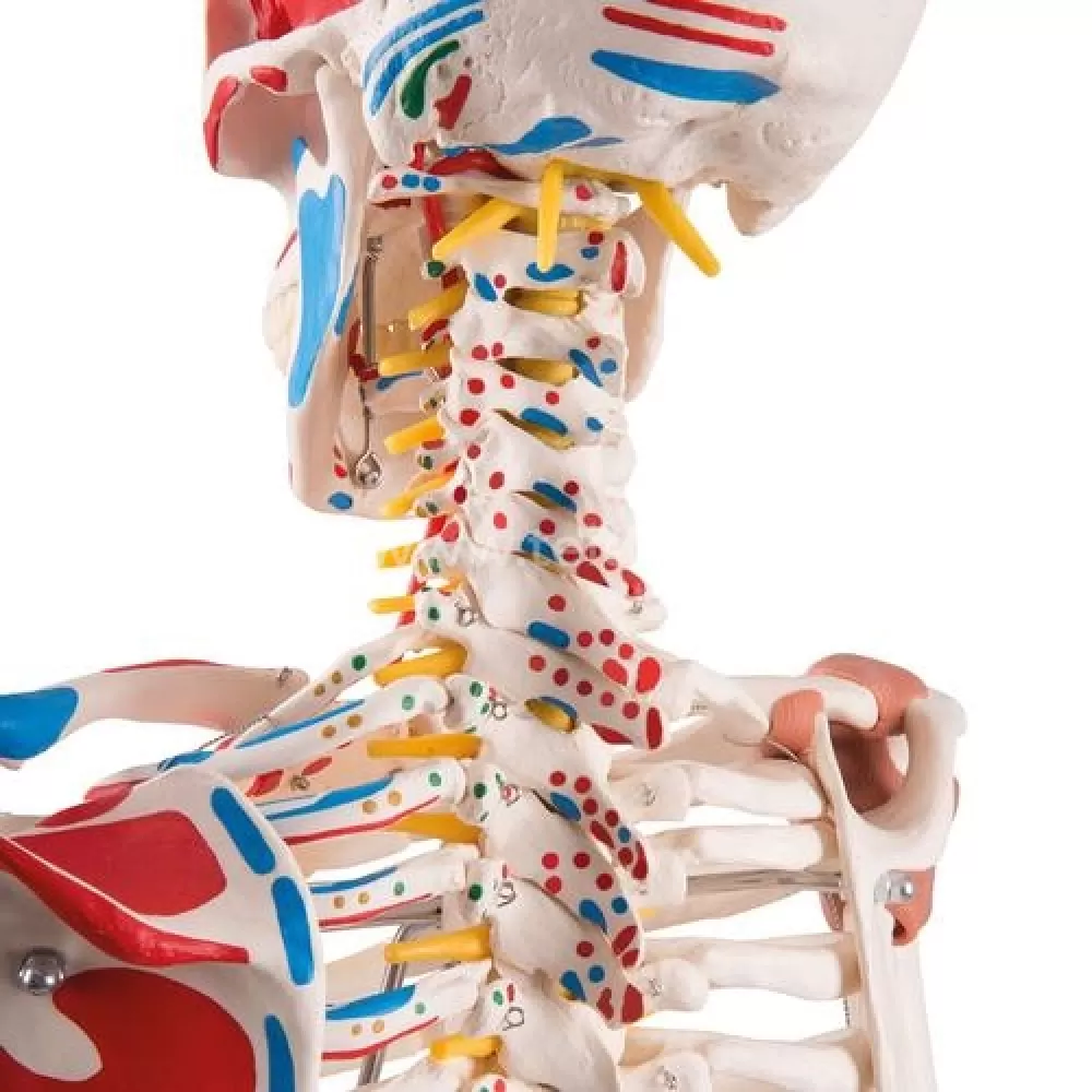 Skeletas su pažymėtomis raumenų, raiščių  prisitvirtinimo vietomis