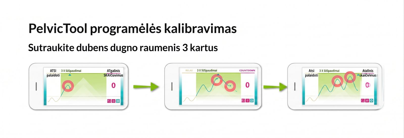 Dubens raumenų treniruoklio kalibravimas Alonea PelvicTOOL
