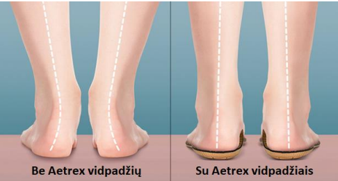 Kūno centravimas ir biometrinis Aetrex vidpadžių veiksmingumas